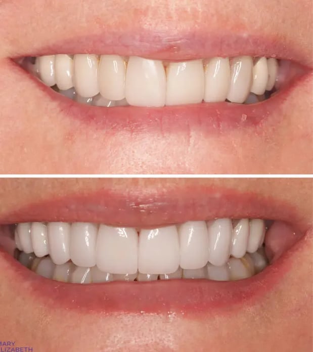 Images Mary Elizabeth Viechnicki, DMD