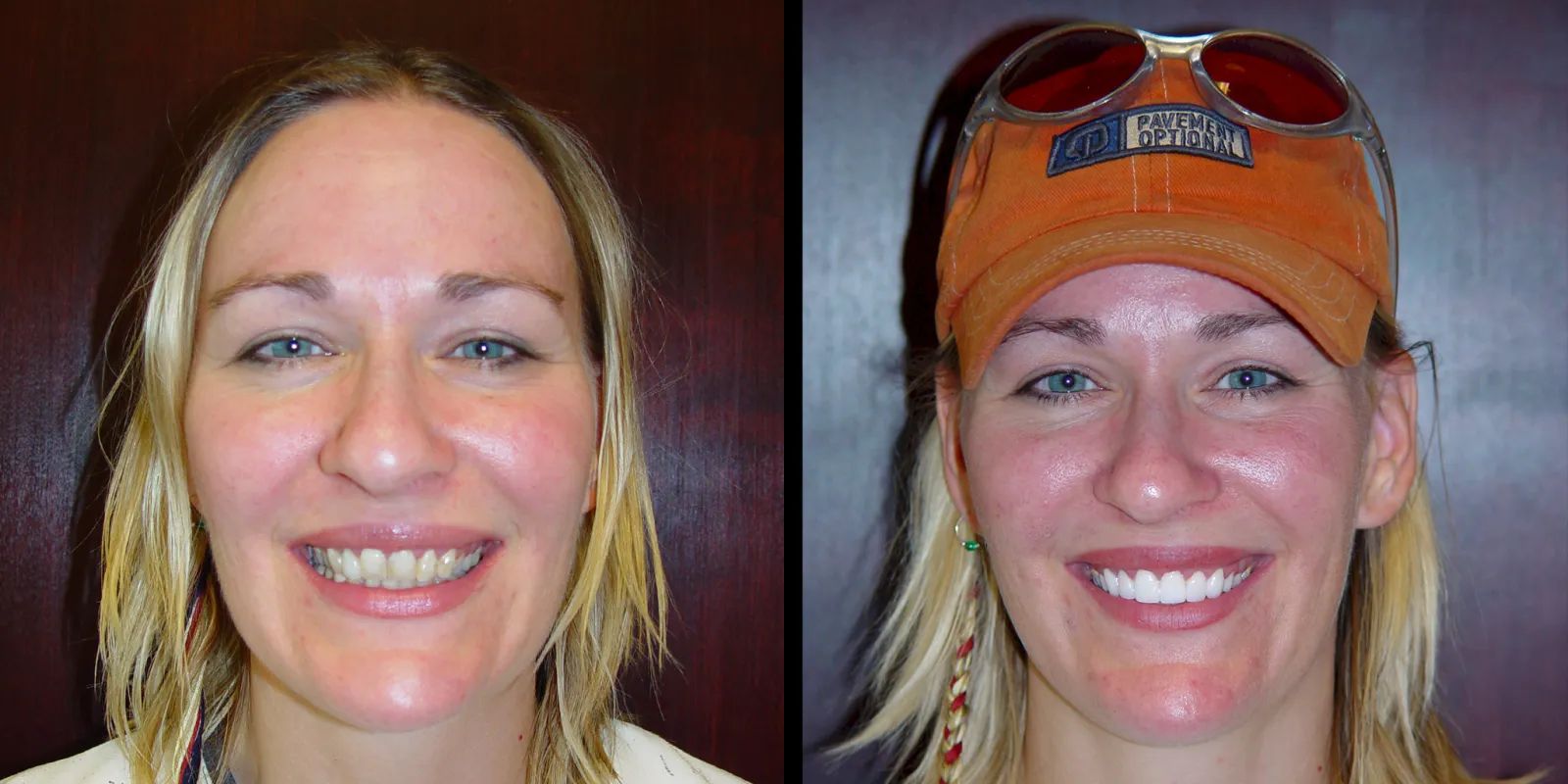 Intermountain Smiles Image