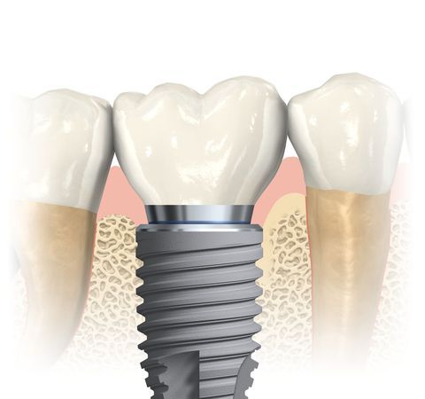 River Valley Advanced Dental & Implant Center Photo