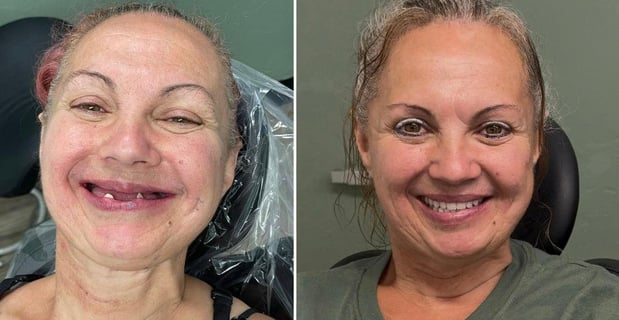 Images Redeemed Smiles - Dentures Implants & Dentistry Yukon