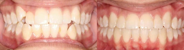 Images Speaker Orthodontics