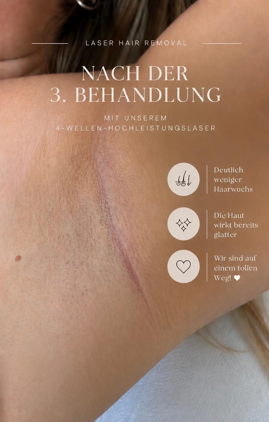 Bild 9 La Perlé Beauty Boutique | Kosmetik & Laserhaarentfernung in Frankfurt am Main
