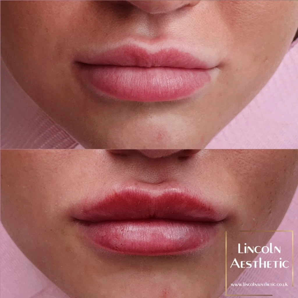 Images Lincoln Aesthetic