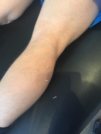 Images KinetikChain Physical Therapy Denver