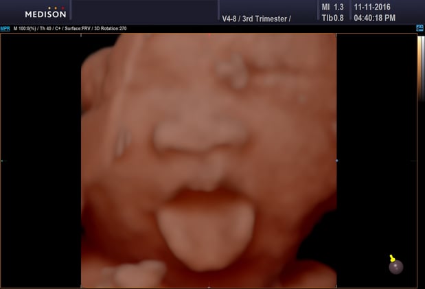 Images Heavenly 3D 4D Ultrasounds