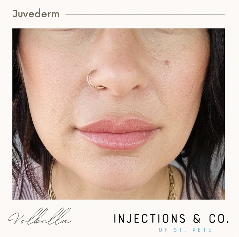Images Injections and Co.