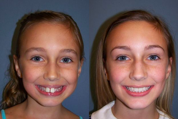 Images Kellyn Hodges Orthodontics