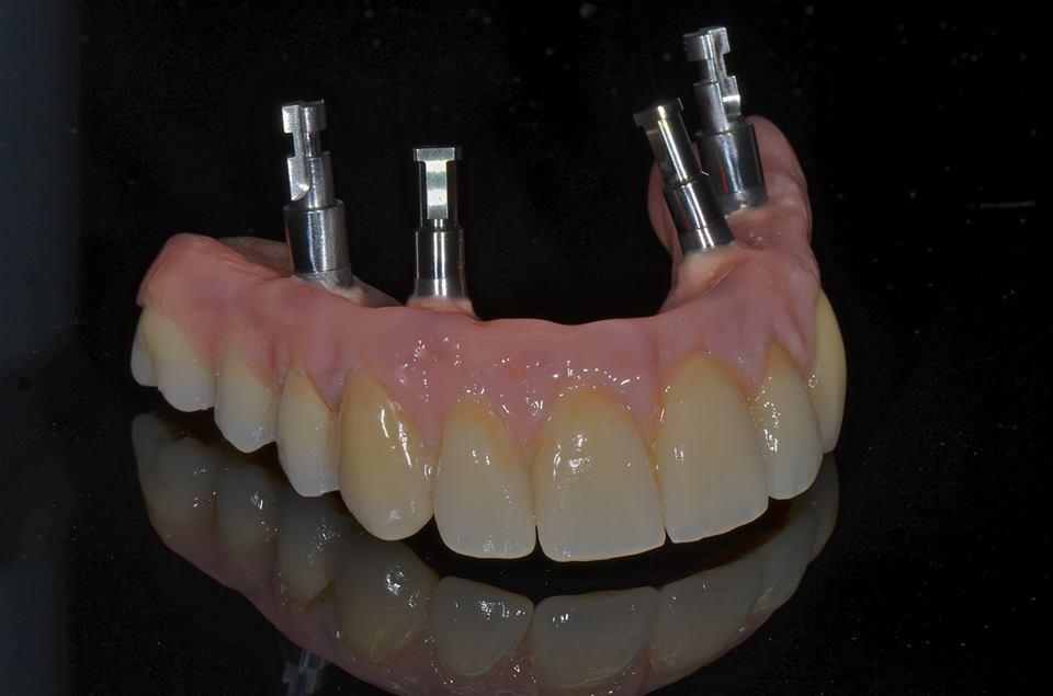 Michael Krieger Zahnmanufaktur, Hansfluhsteig 2 in Brugg