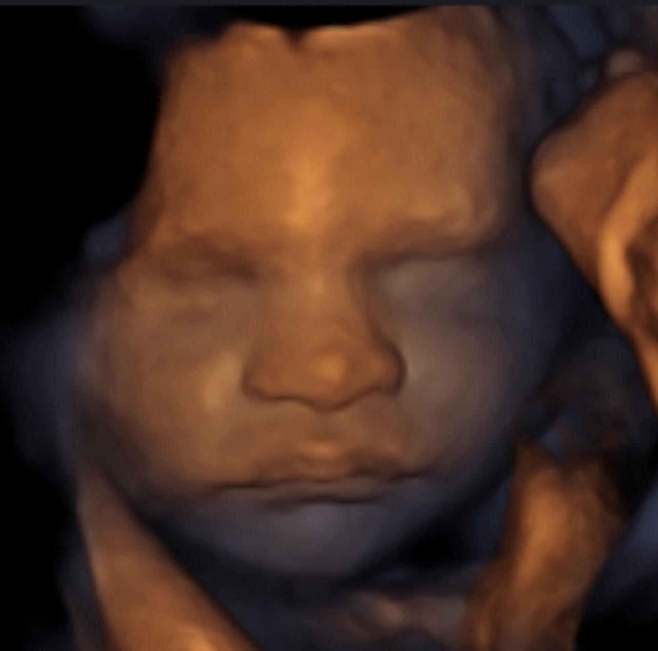 Image 4 | Belly 2 Birth 3D 4D Ultrasound