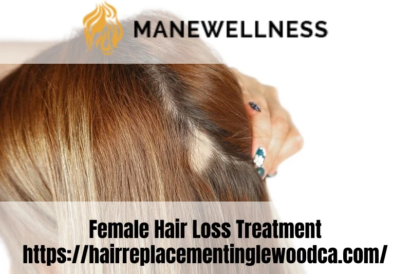 Images Mane Wellness Hair Loss Center