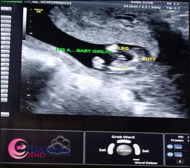 Images Heavenly 3D 4D Ultrasounds