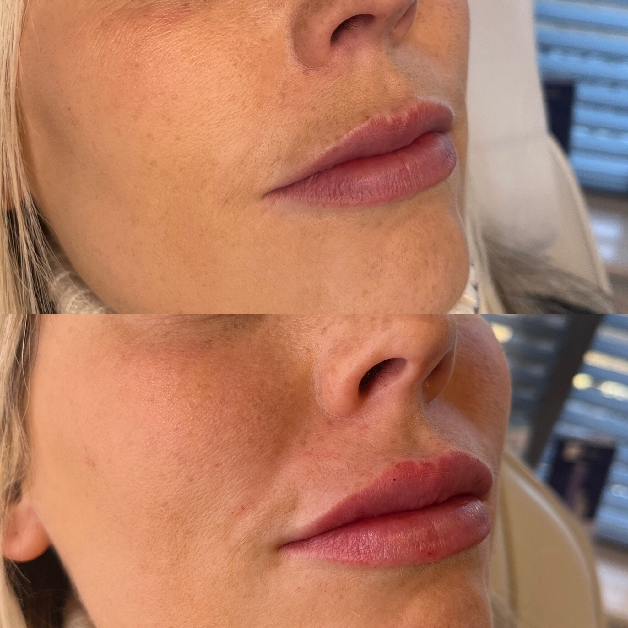 Images Harvey Medical Aesthetics