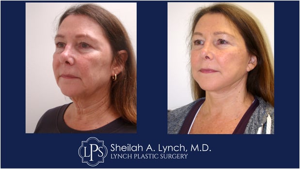 Images Dr. Sheilah A. Lynch