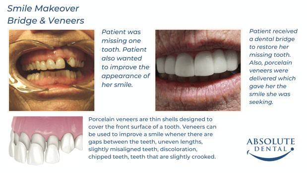 Images Absolute Dental