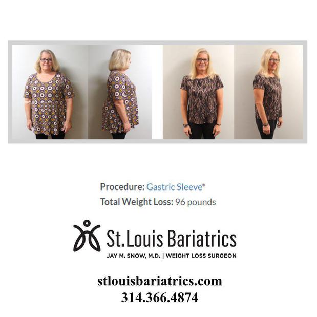 Images St. Louis Bariatrics: Jay Michael Snow, MD