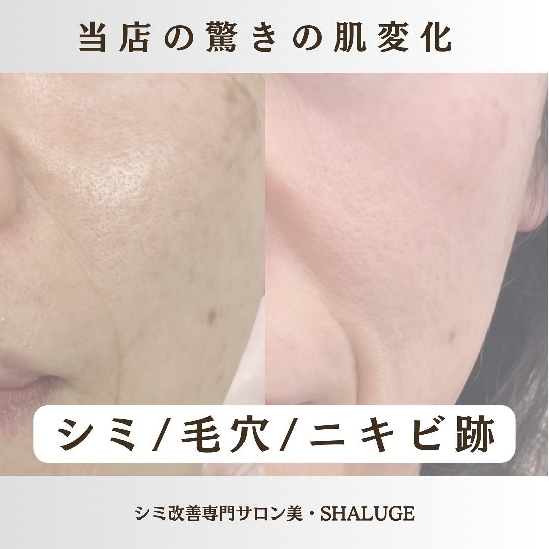Images 美・SHALUGE
