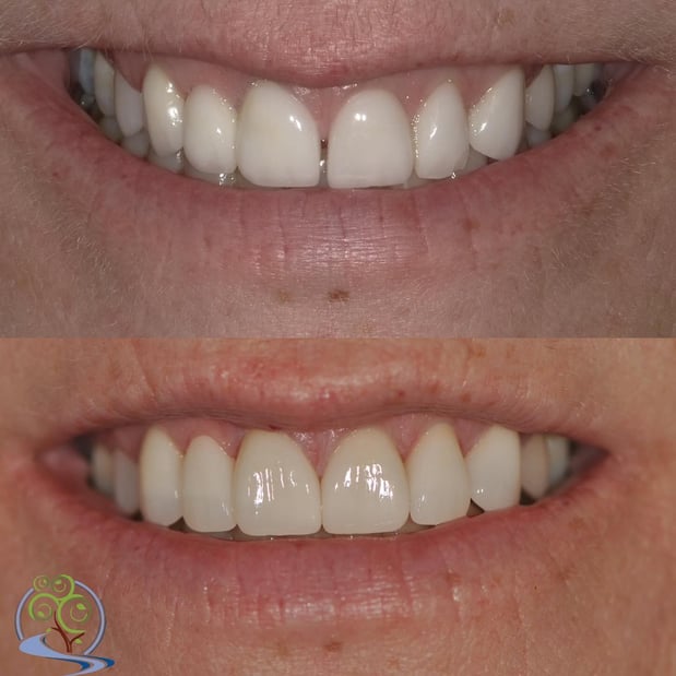 Images Reimels Family & Cosmetic Dentistry