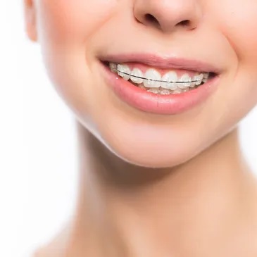 Images Irvine Smile Dentistry