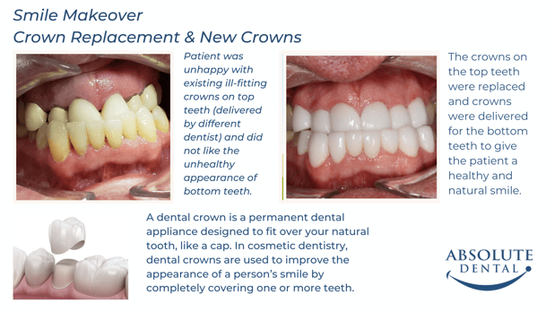 Images Absolute Dental