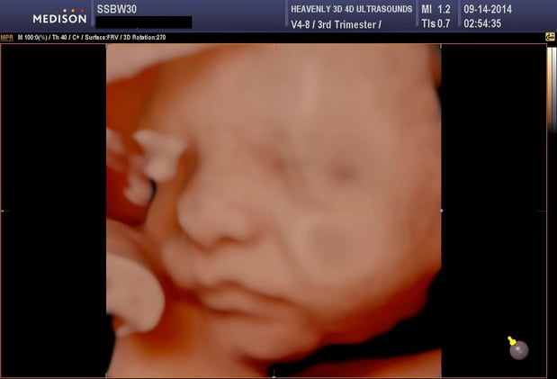 Images Heavenly 3D 4D Ultrasounds-Apple Valley