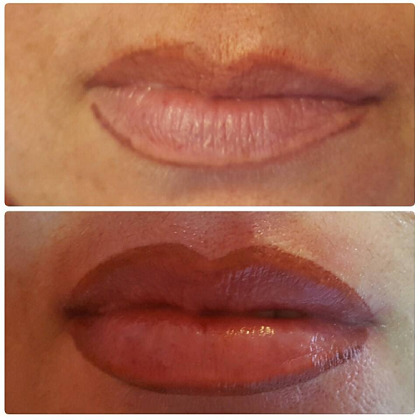 Images Estetica Athena