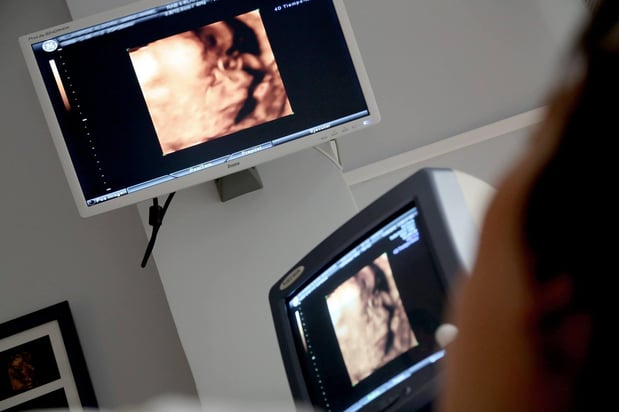 Images Heavenly 3D 4D Ultrasounds