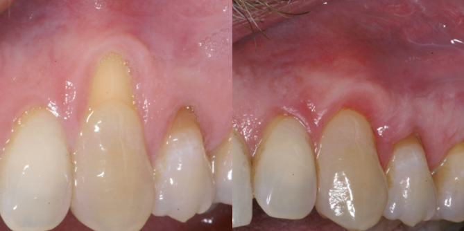 Images Advanced Periodontics and Dental Implants, LLC