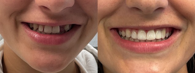 Images Marin Modern Dentistry