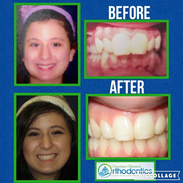 Images Maryland Advanced Orthodontics: David S. Lavine, DDS, MS