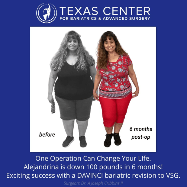 Images Texas Center for Bariatrics & Advanced Surgery