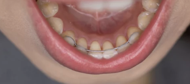 Images Emergency Dental of Dayton