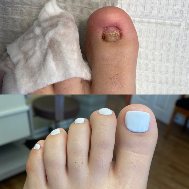 Images Smith Medical Pedicures