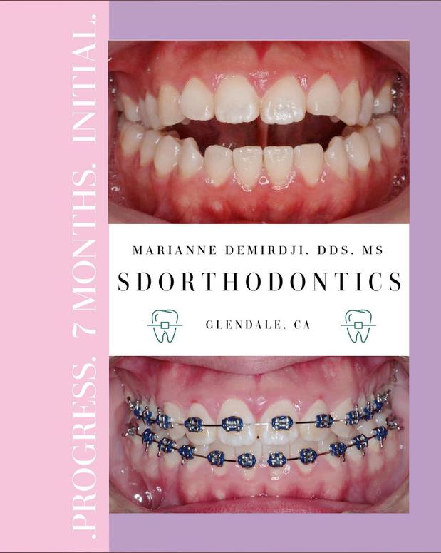 Images SDOrthodontics Glendale | Marianne Demirdji, DDS, MS