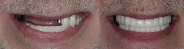 Images Watters Creek Dental