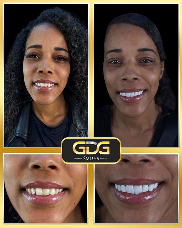 Images GDG Smiles