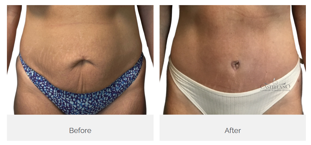 Castellano Cosmetic Surgery Center Image