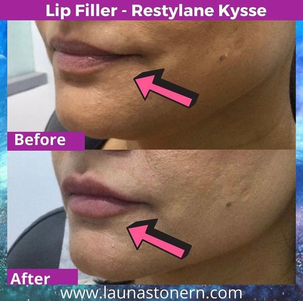 Images Launa Stone, R.N.