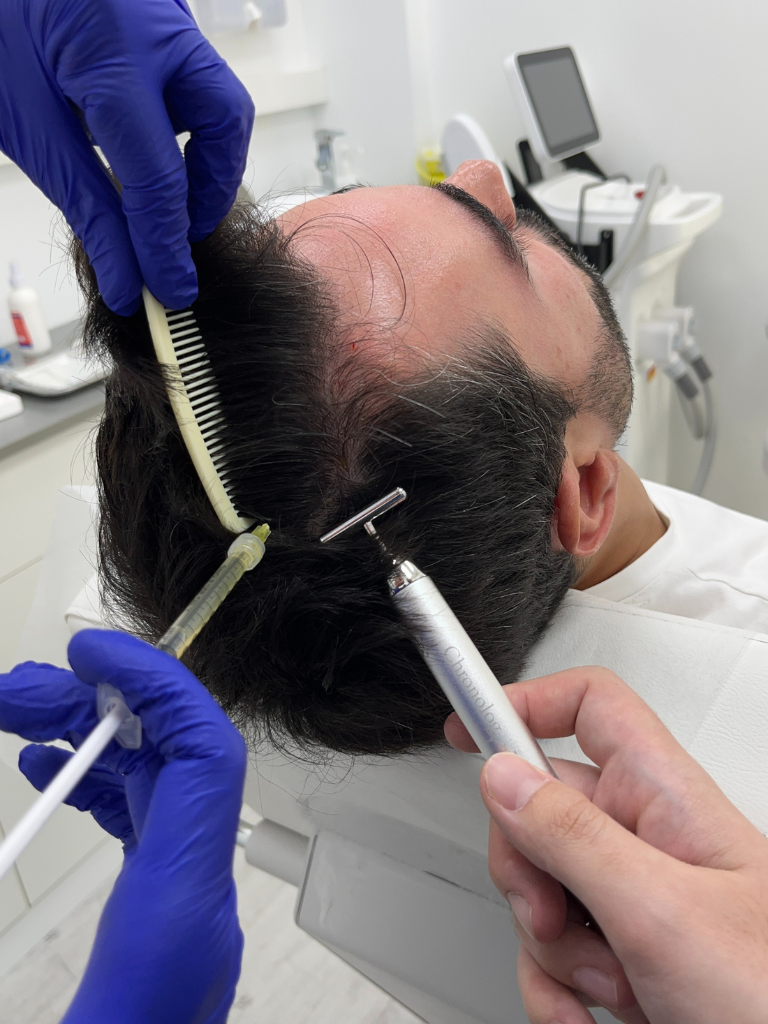 Images Dra. Silvia Solà. Medicina Estética y Láser