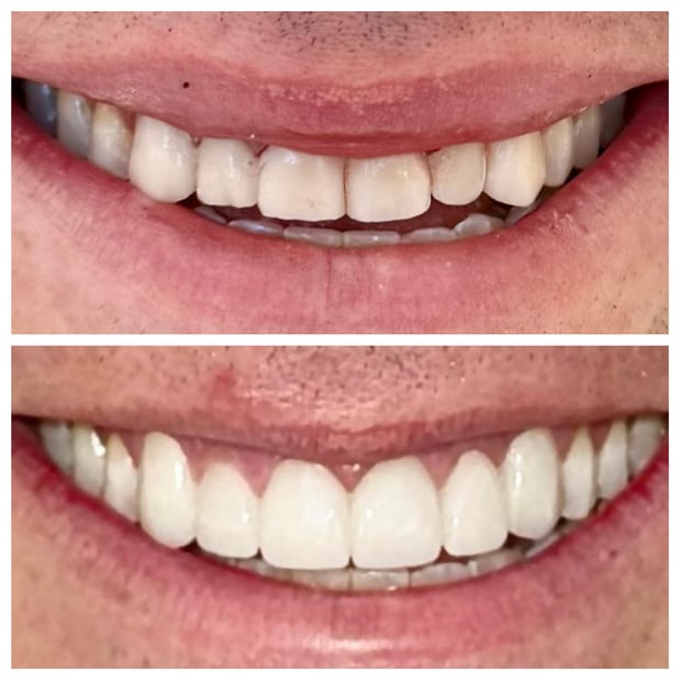 Images Summerlin Dental Solutions