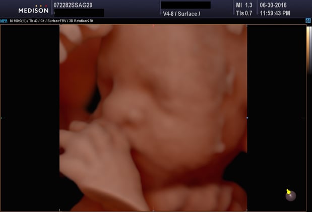 Images Heavenly 3D 4D Ultrasounds