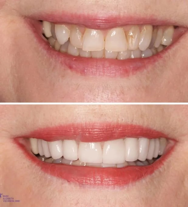 Images Mary Elizabeth Viechnicki, DMD