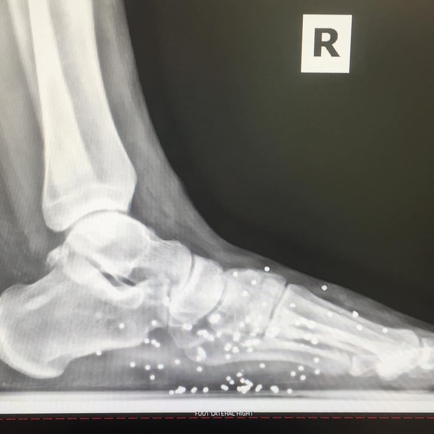 Images Premier Foot & Ankle