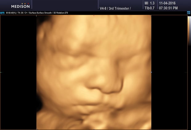 Images Heavenly 3D 4D Ultrasounds