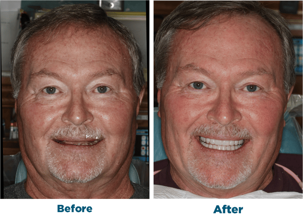 Images Smiles for Life Dental Care - Bridgewater