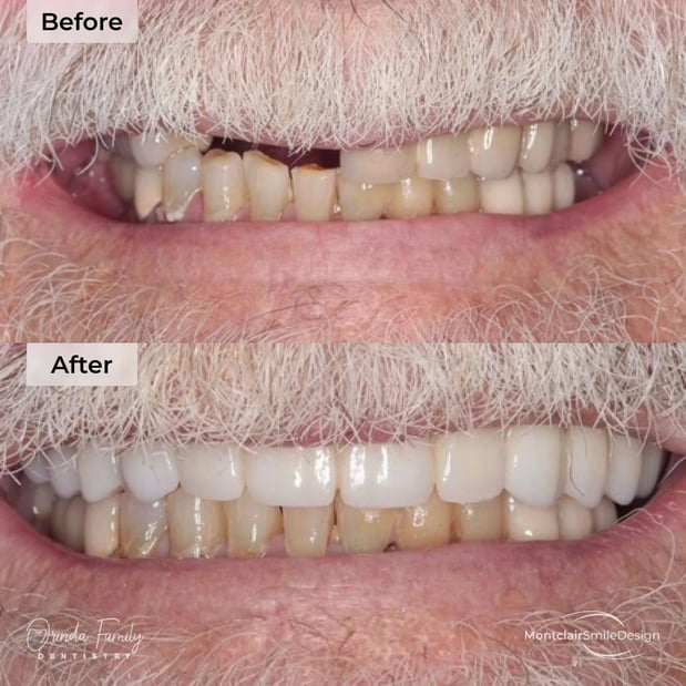 Images Orinda Family Dentistry