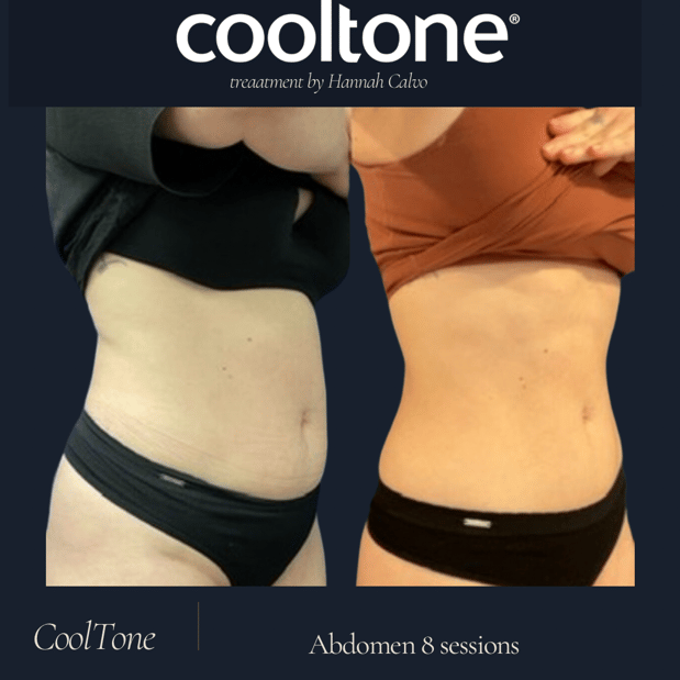 Images Pier Aesthetics: Douglas Mest, MD