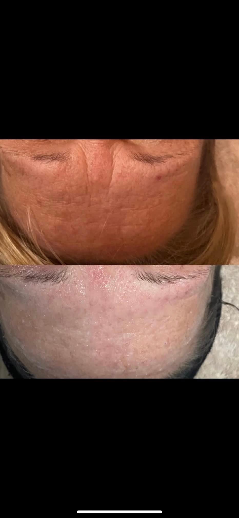 Images Cheshire Treatments