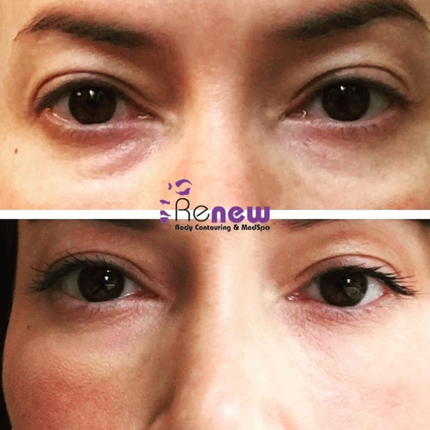 Images Renew Body Contouring & MedSpa