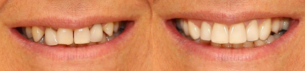 Images Cosmetic and Implant Dentistry of Connecticut