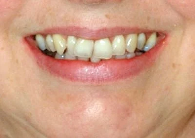 Images Smile Dental Laboratory